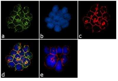 Immunofluorescence: TCR V beta 8a Antibody (I6G8) [NBP2-22502]