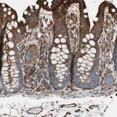 Immunohistochemistry-Paraffin: TCTA Antibody [NBP1-86497]