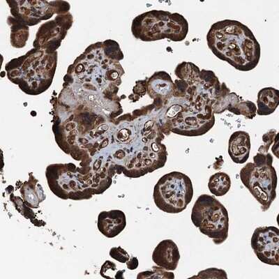 Immunohistochemistry-Paraffin: TCTN1 Antibody [NBP1-83623]
