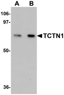 Western Blot: TCTN1 AntibodyBSA Free [NBP1-77182]