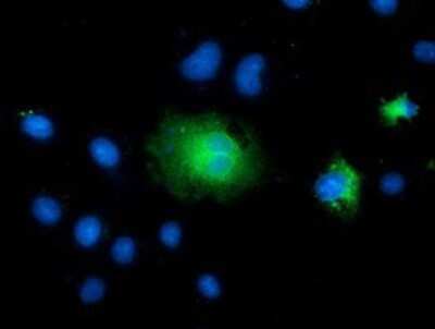Immunocytochemistry/ Immunofluorescence: TCTN2 Antibody (OTI1C1) - Azide and BSA Free [NBP2-74483]
