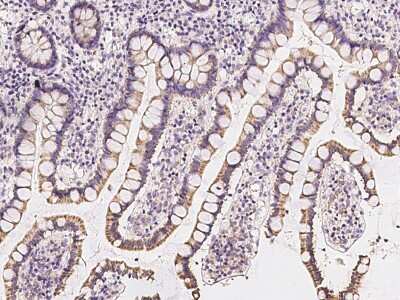 Immunohistochemistry-Paraffin: TCTN3 Antibody [NBP2-97323]