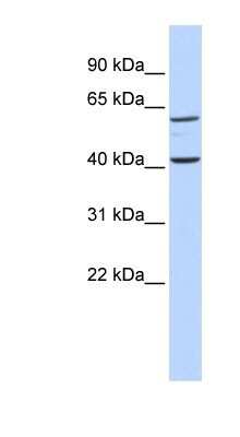Western Blot: TCTN3 Antibody [NBP1-59741]