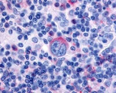 Immunohistochemistry-Paraffin: TDAG8/GPR65 Antibody - BSA Free [NLS1625]