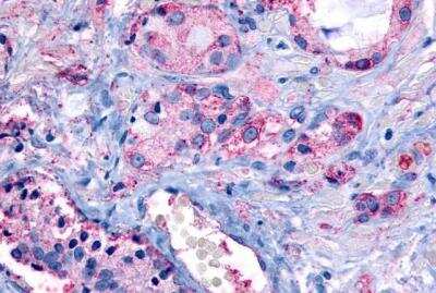 Immunohistochemistry-Paraffin: TDAG8/GPR65 Antibody - BSA Free [NLS1625]