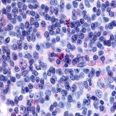 Immunohistochemistry-Paraffin: TDAG8/GPR65 Antibody - BSA Free [NLS1627]