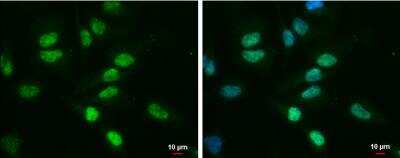 Immunocytochemistry/ Immunofluorescence: TDG Antibody (1142) [NBP2-43595]