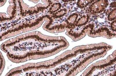 Immunohistochemistry-Paraffin: TDG Antibody (1511) [NBP2-43718]