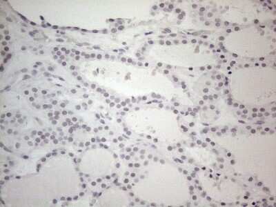 Immunohistochemistry: TDG Antibody (OTI3C11) [NBP2-46091]