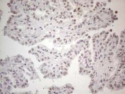 Immunohistochemistry: TDG Antibody (OTI3C11) [NBP2-46091]