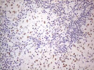 Immunohistochemistry: TDG Antibody (OTI3C11) [NBP2-46091]