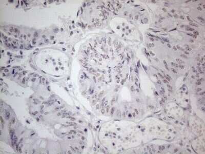 Immunohistochemistry: TDG Antibody (OTI3C11) - Azide and BSA Free [NBP2-74484]