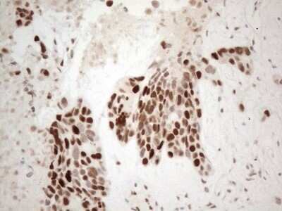 Immunohistochemistry: TDG Antibody (OTI3C11) - Azide and BSA Free [NBP2-74484]