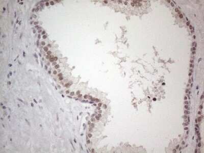 Immunohistochemistry: TDG Antibody (OTI3C11) - Azide and BSA Free [NBP2-74484]