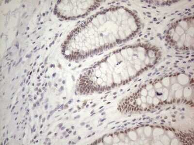 Immunohistochemistry: TDG Antibody (OTI3C11) - Azide and BSA Free [NBP2-74484]