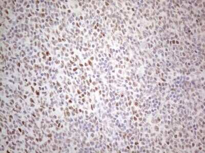 Immunohistochemistry: TDG Antibody (OTI3C11) - Azide and BSA Free [NBP2-74484]