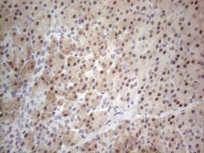 Immunohistochemistry: TDG Antibody (OTI3C11) - Azide and BSA Free [NBP2-74484]