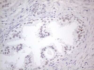 Immunohistochemistry: TDG Antibody (OTI3C11) - Azide and BSA Free [NBP2-74484]