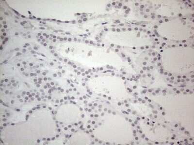 Immunohistochemistry: TDG Antibody (OTI3C11) - Azide and BSA Free [NBP2-74484]
