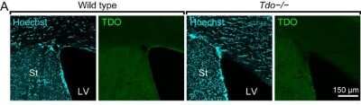 Immunohistochemistry: TDO2 Antibody [H00006999-B01P]