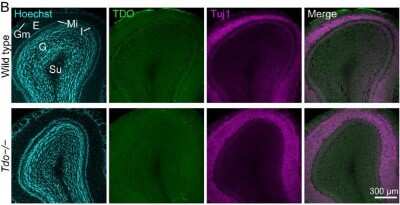 Immunohistochemistry: TDO2 Antibody [H00006999-B01P]