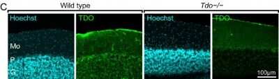 Immunohistochemistry: TDO2 Antibody [H00006999-B01P]
