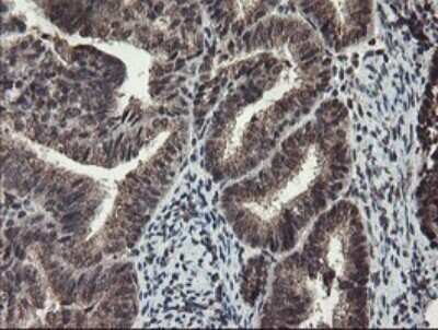 Immunohistochemistry: TDO2 Antibody (OTI2A4) - Azide and BSA Free [NBP2-74486]
