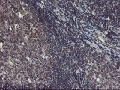 Immunohistochemistry: TDO2 Antibody (OTI2A4) - Azide and BSA Free [NBP2-74486]