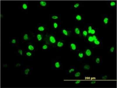 Immunocytochemistry/ Immunofluorescence: TDP-43/TARDBP Antibody (2E2-D3) [H00023435-M01]
