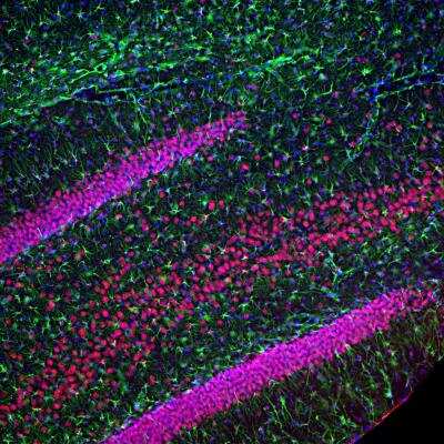 Immunohistochemistry Free-Floating: TDP-43/TARDBP Antibody (3H8) [NBP1-92695]