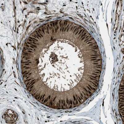 Immunohistochemistry-Paraffin: TDP-43/TARDBP Antibody [NBP1-89116]
