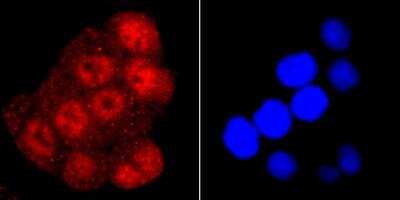Immunocytochemistry/ Immunofluorescence: TDP-43/TARDBP Antibody (JM51-10) [NBP2-80137]