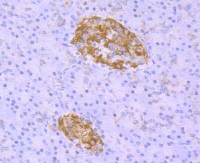 Immunocytochemistry/ Immunofluorescence: TDP-43/TARDBP Antibody (JM51-10) [NBP2-80137]