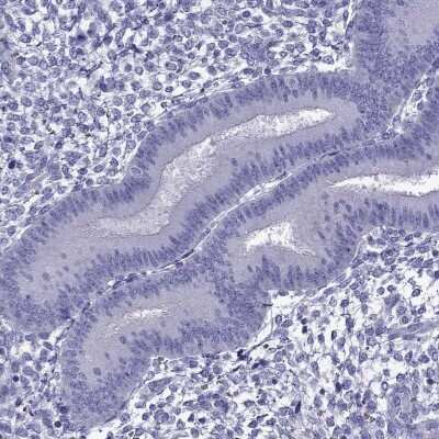 Immunohistochemistry-Paraffin: TDRD1 Antibody [NBP1-84349]