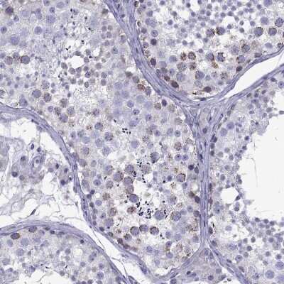Immunohistochemistry-Paraffin: TDRD1 Antibody [NBP1-84349]