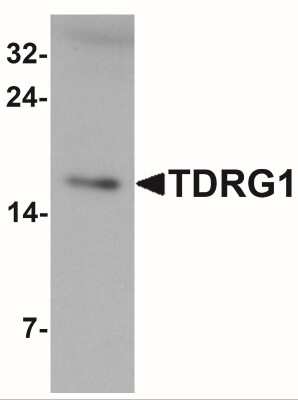 Western Blot: TDRG1 AntibodyBSA Free [NBP2-41197]
