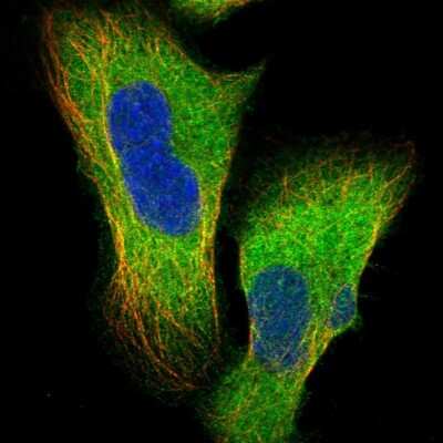 Immunocytochemistry/ Immunofluorescence: TDRKH Antibody [NBP1-80697]