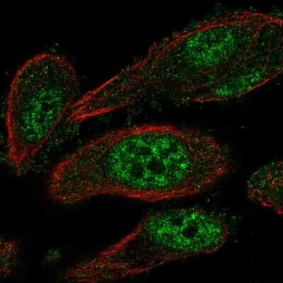 Immunocytochemistry/ Immunofluorescence: TEAD2 Antibody [NBP2-55789]