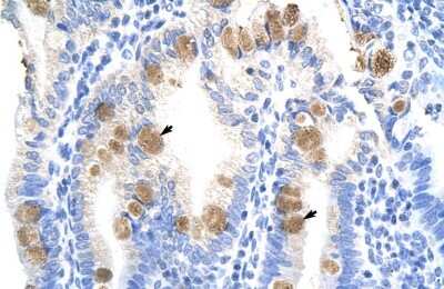 Immunohistochemistry: TEAD3 Antibody [NBP2-85896]