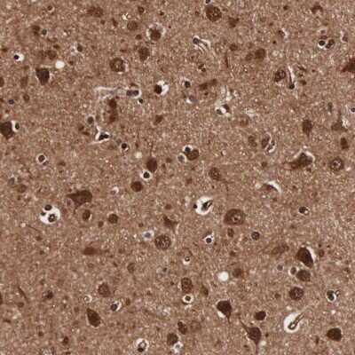 Immunohistochemistry-Paraffin: TECPR2 Antibody [NBP1-93642]