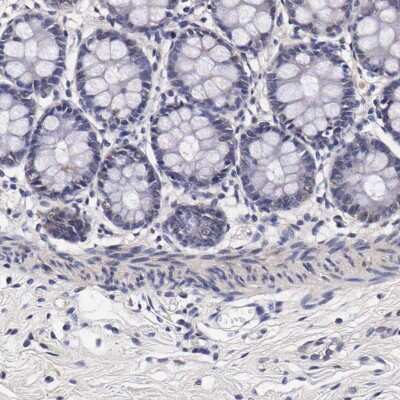 Immunohistochemistry-Paraffin: TECPR2 Antibody [NBP1-93642]