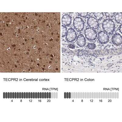 Immunohistochemistry-Paraffin: TECPR2 Antibody [NBP1-93642]