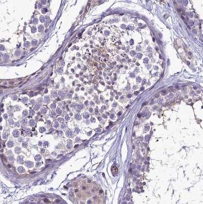 Immunohistochemistry-Paraffin: TEKT3 Antibody [NBP1-92488]