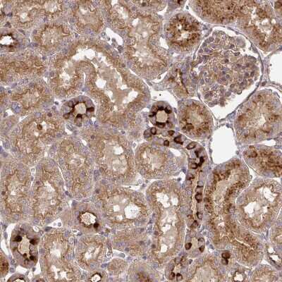 Immunohistochemistry-Paraffin: TEM Antibody [NBP2-49189]