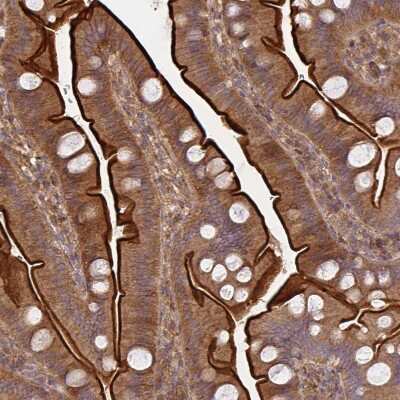 Immunohistochemistry-Paraffin: TEM Antibody [NBP2-49189]
