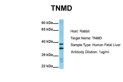 Western Blot: TEM Antibody [NBP2-88428]