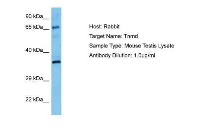 Western Blot: TEM Antibody [NBP2-88428]