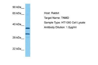 Western Blot: TEM Antibody [NBP2-88428]