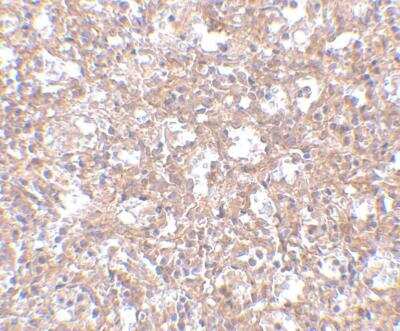 Immunohistochemistry-Paraffin: TEM4 Antibody - BSA Free [NBP1-77314]