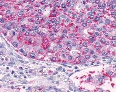 Immunohistochemistry-Paraffin: TEM5/GPR124 Antibody - BSA Free [NLS2171]